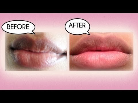 Tips on how to take care of dark lips